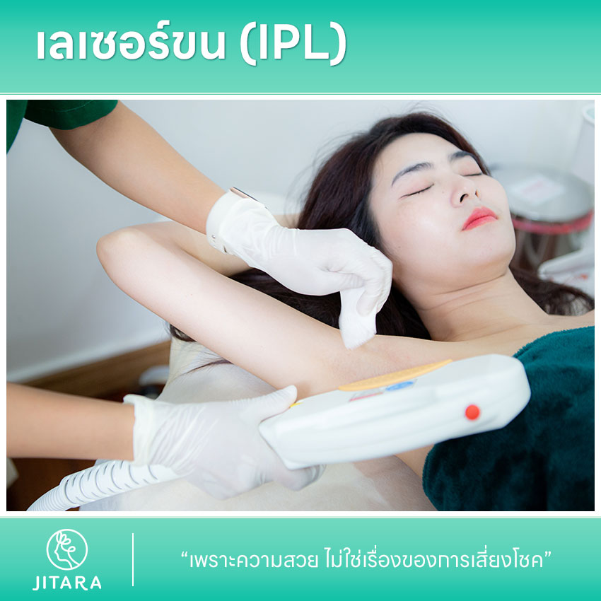 รีวิว เลเซอร์ขน (IPL) | jitaraclinic