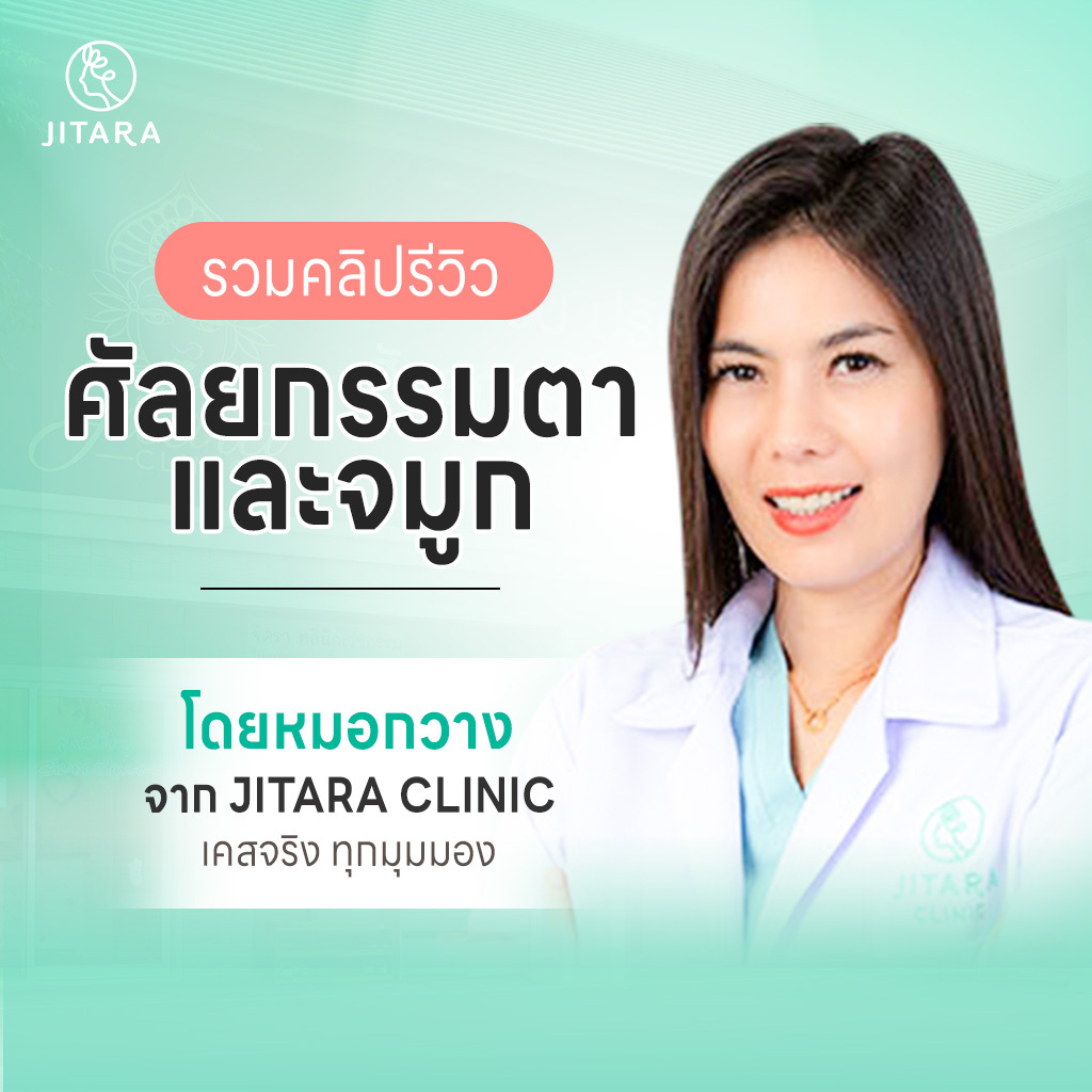 รวมคลิปรีวิวศัลยกรรมตาและจมูกโดยหมอกวาง เคสจริงจาก Jitara Clinic