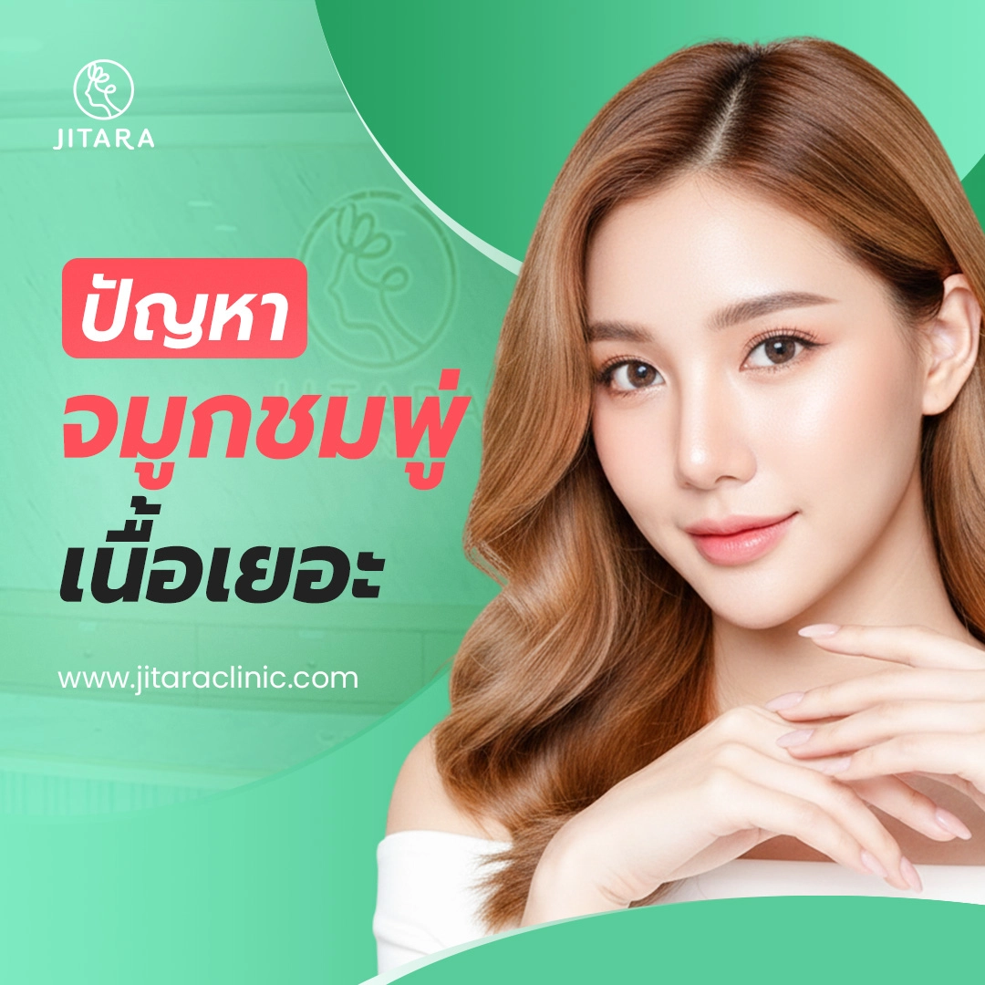 ปัญหาจมูกชมพู่ เนื้อเยอะ