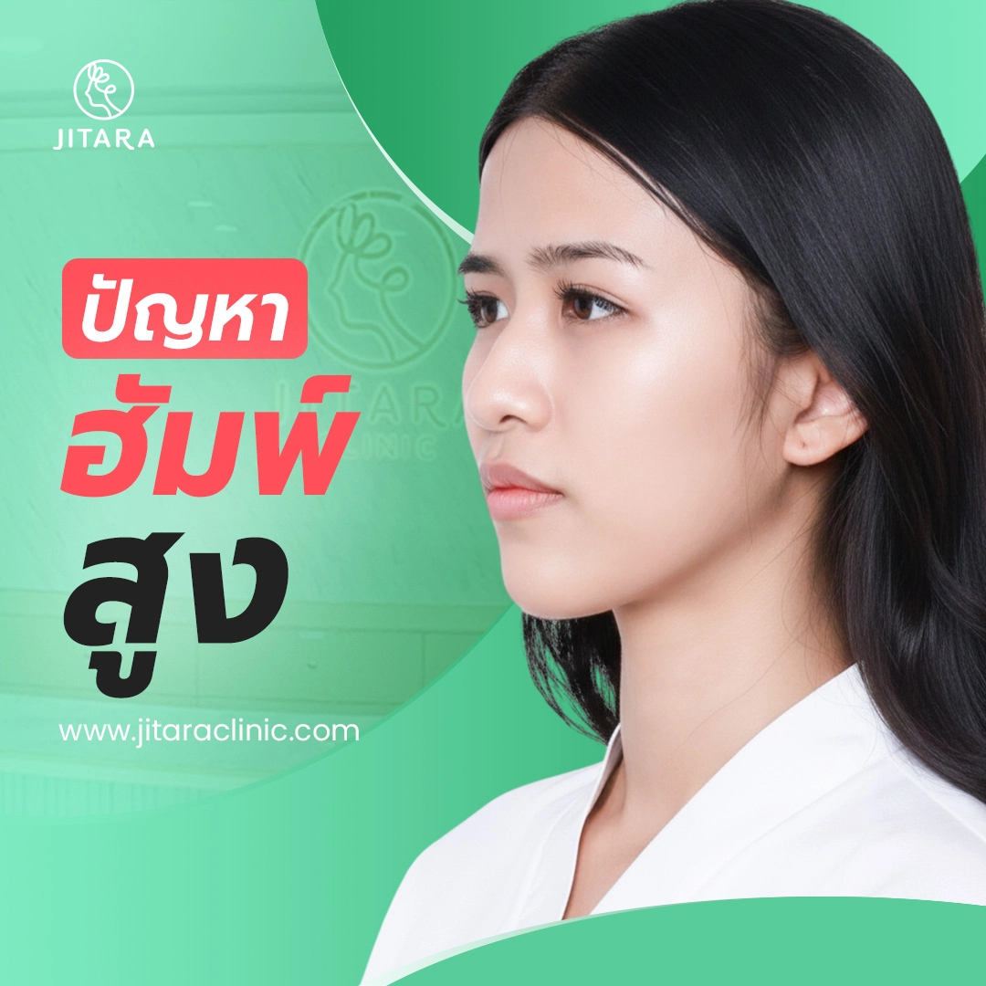 ปัญหาฮัมพ์สูง