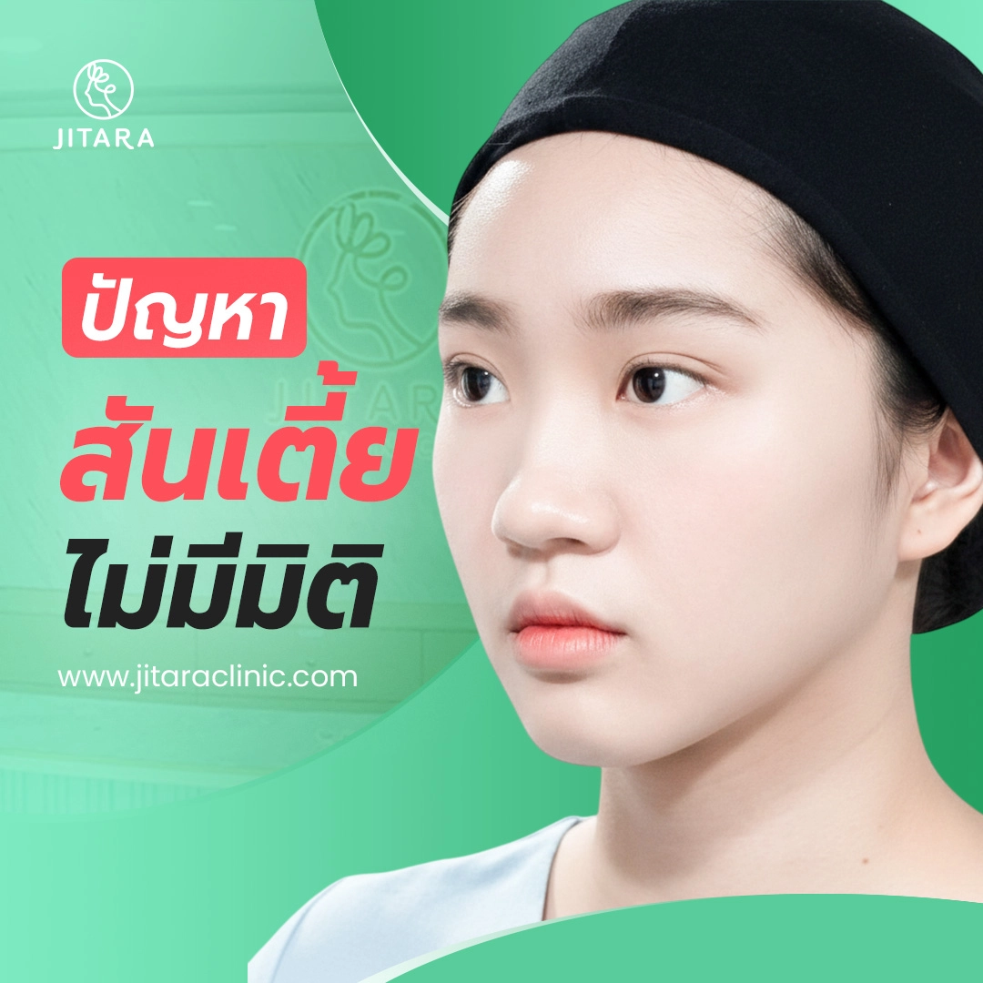 ปัญหาสันเตี้ย ไม่มีมิติ