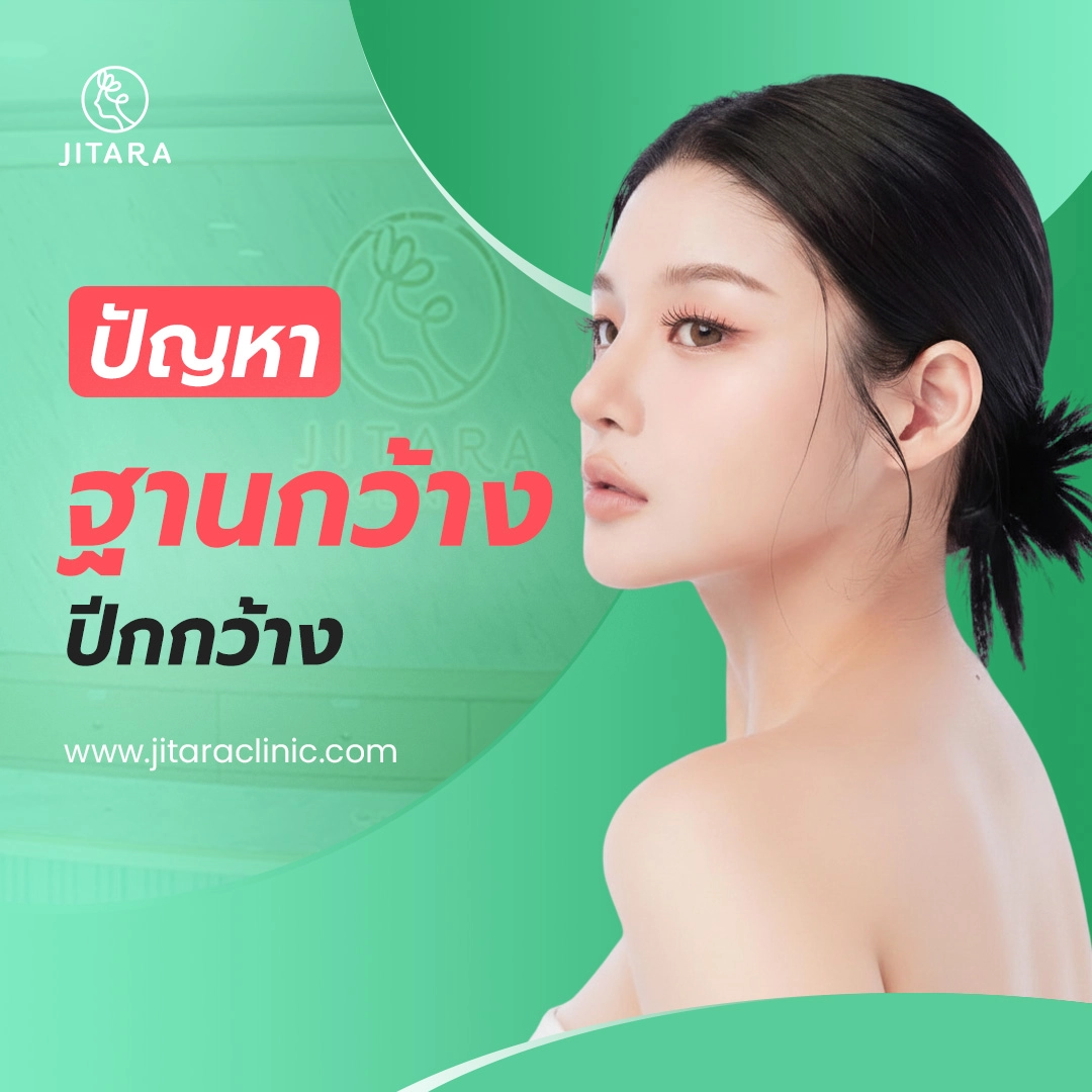 ปัญหาฐานกว้าง ปีกกว้าง